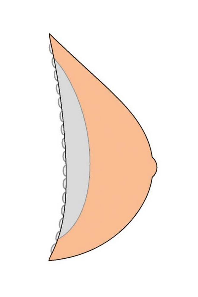 Breast Form Z8840